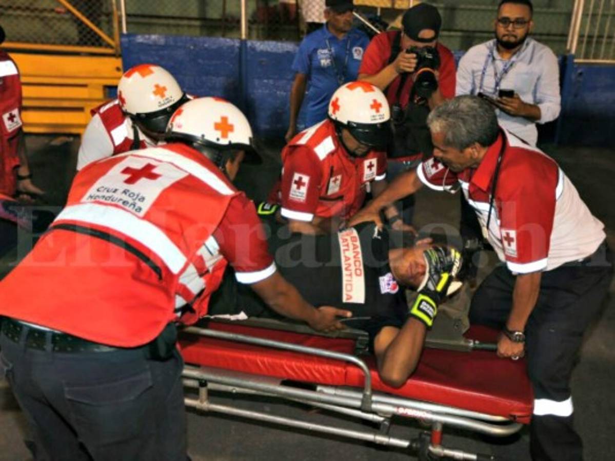 ¡ALARMA! Donis Escober se fracturó el pómulo derecho y será operado esta noche