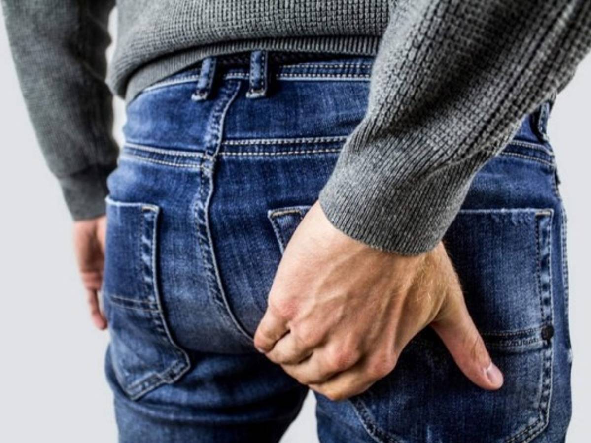 ¿Qué son las hemorroides y cómo tratarlas?