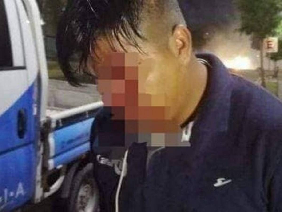 El profesional de las cámaras estaba cubriendo las protestas cuando fue agredido por los uniformados.