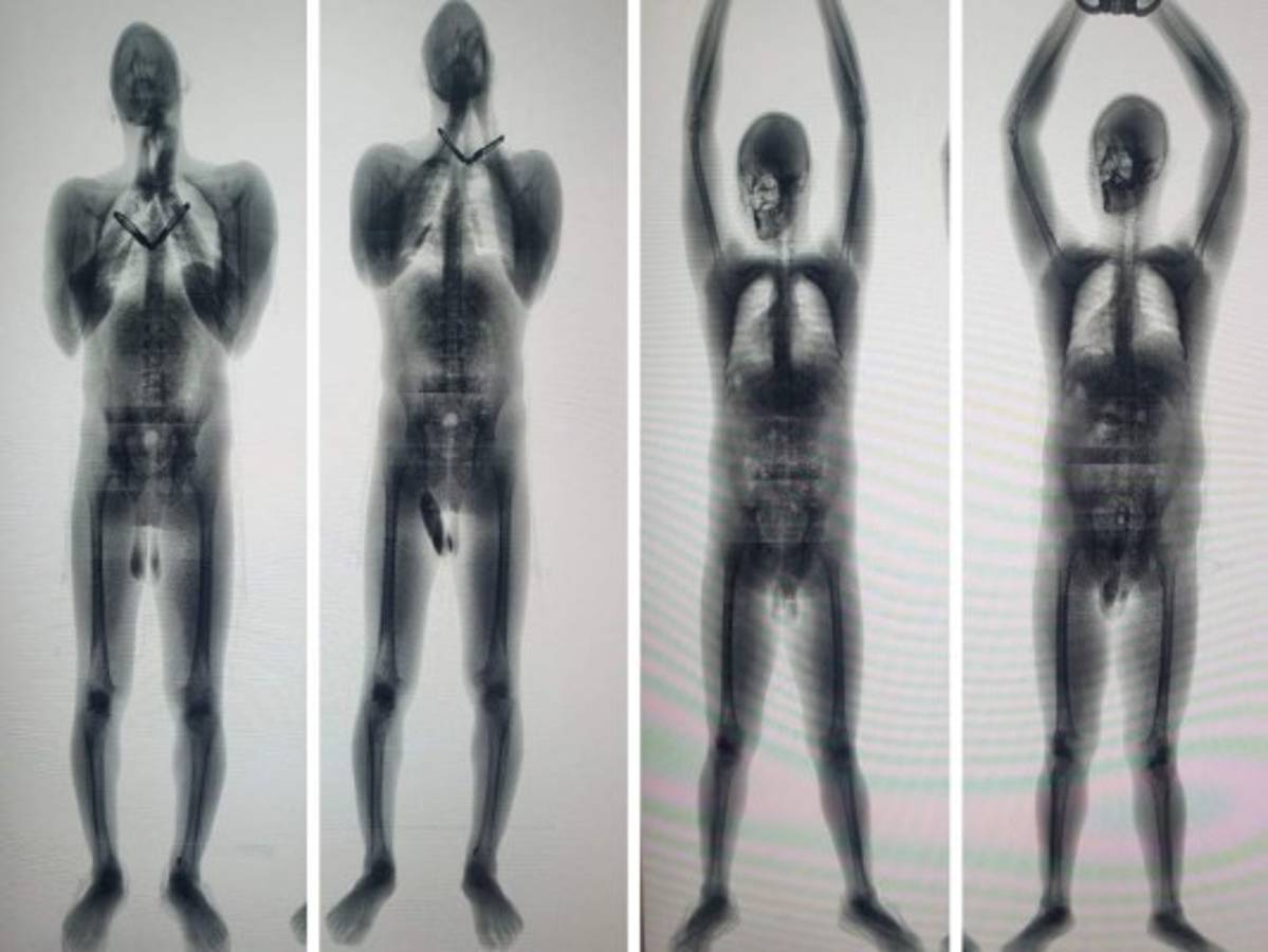 Madres que visitaron a sus hijos introdujeron droga en El Pozo I, en Ilama, Santa Bárbara