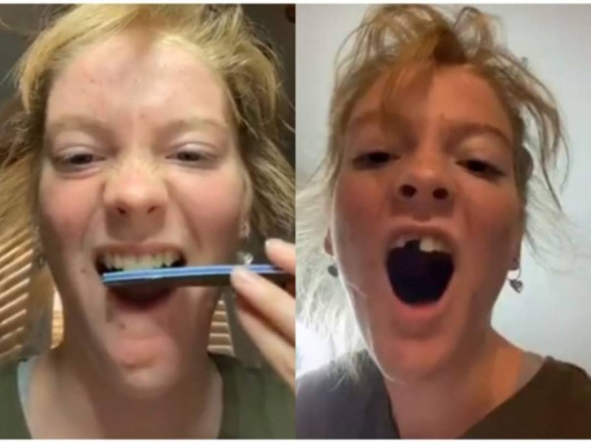 Limarse los dientes, la peligrosa tendencia viral en TikTok  