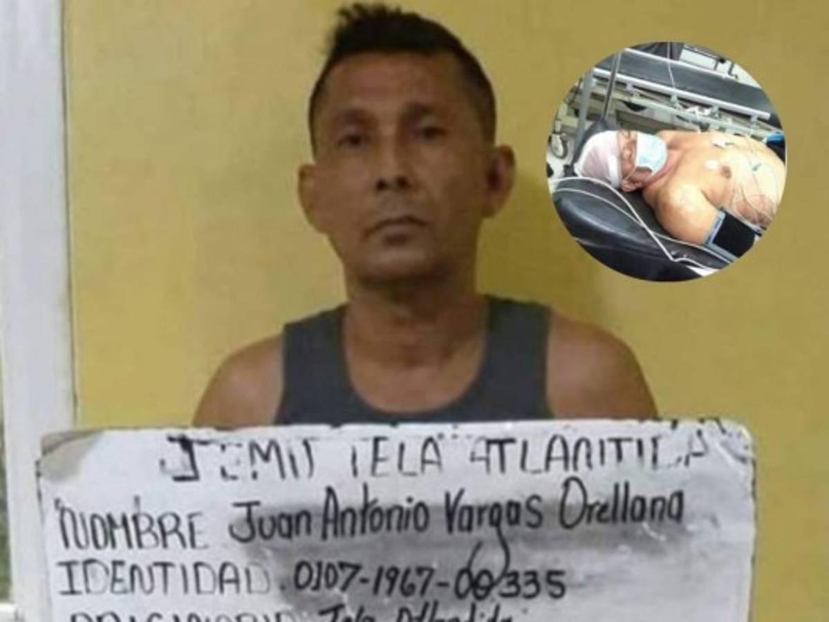 Por enamorar a su mujer, expastor machetea a taxista en Tela, Atlántida  