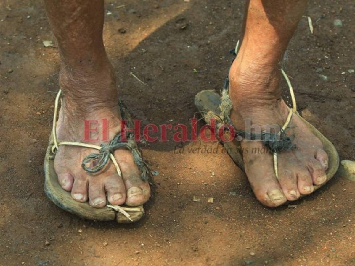 Los niños no tienen zapatos y también hay adultos mayores que usan caites debido a la necesidad. Foto Alex Pérez| EL HERALDO