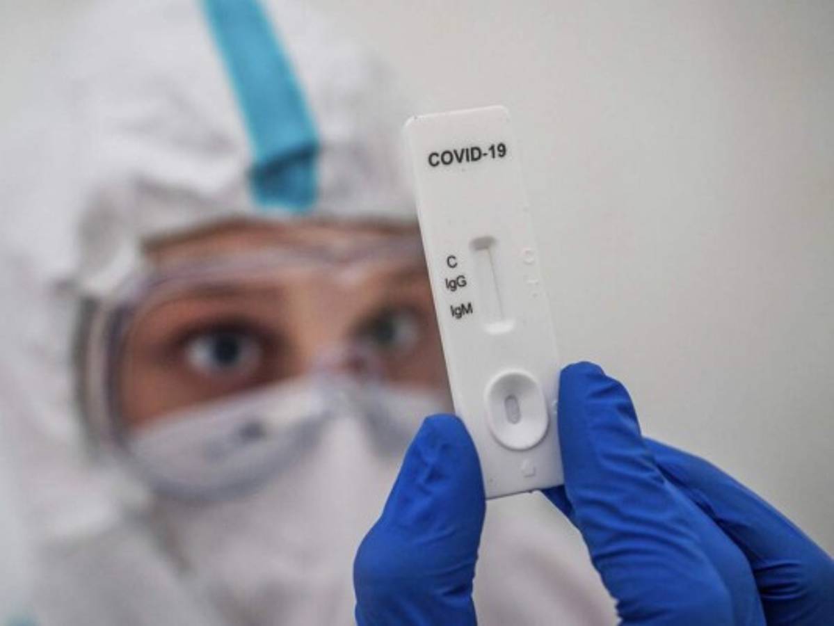 Recomiendan nueva prueba rápida para detectar Covid-19