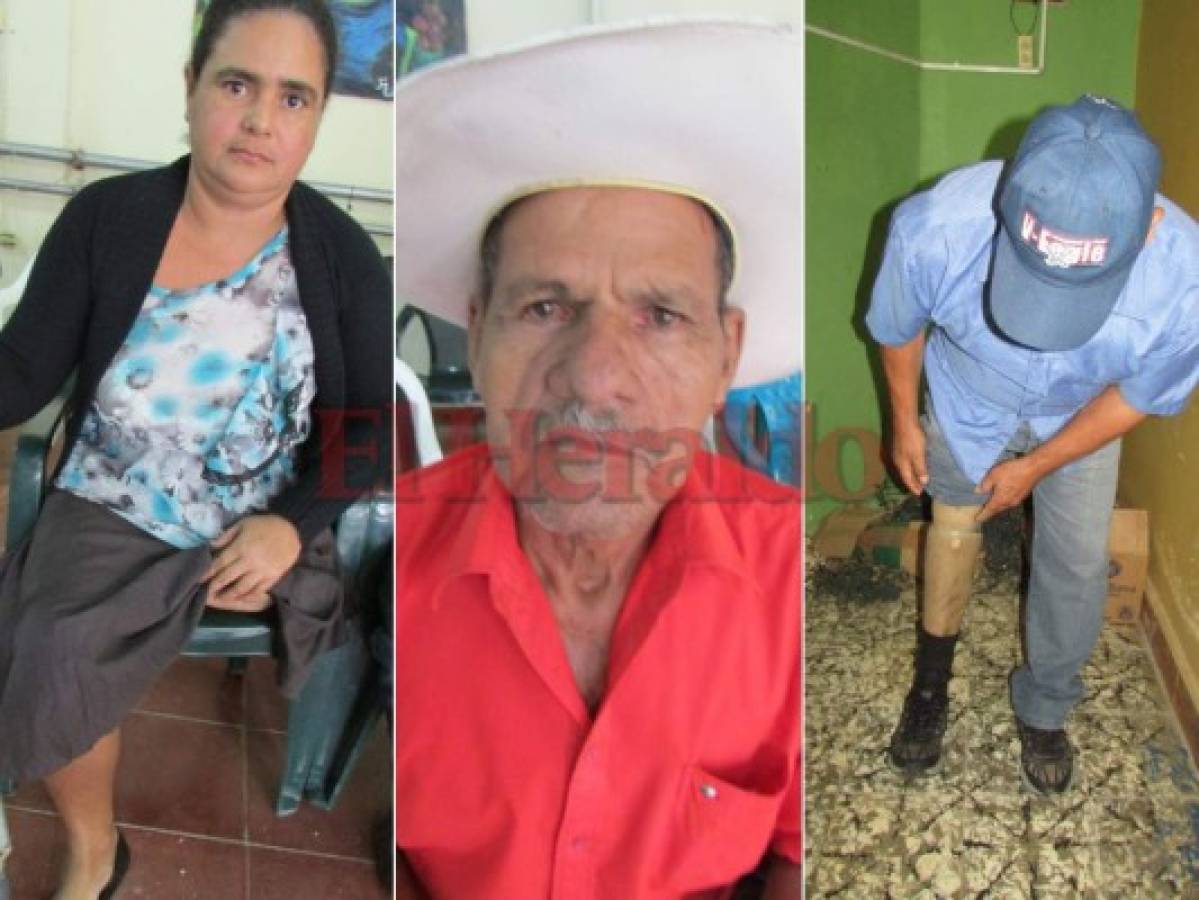 Afectados por la guerra urgen de prótesis en Alauca, El Paraíso
