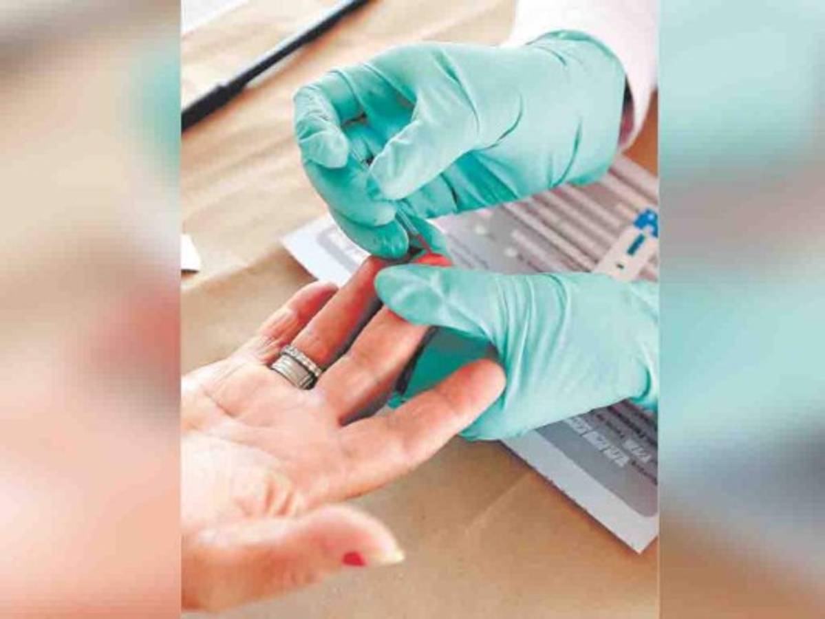 Tres personas mueren a diario a causa del sida