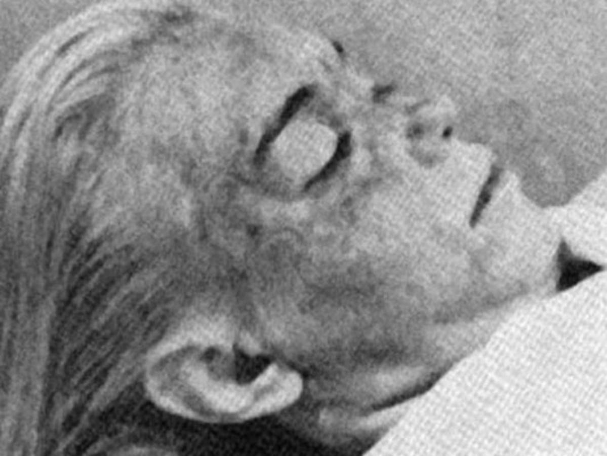 El cuerpo de la actriz con una sábana blanca hasta la barbilla mientras su rostro parecía demacrado y sin color. Foto: Clarín.