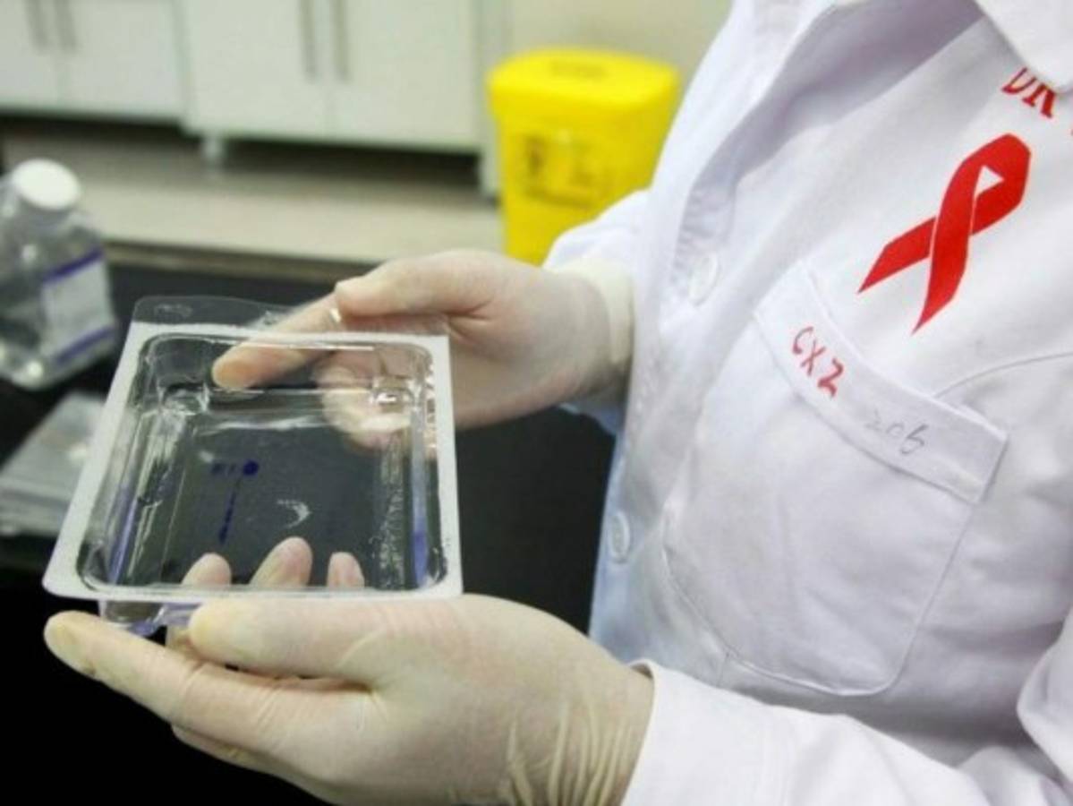 Chile: Se duplican los contagios por VIH, mayor porcentaje de América Latina