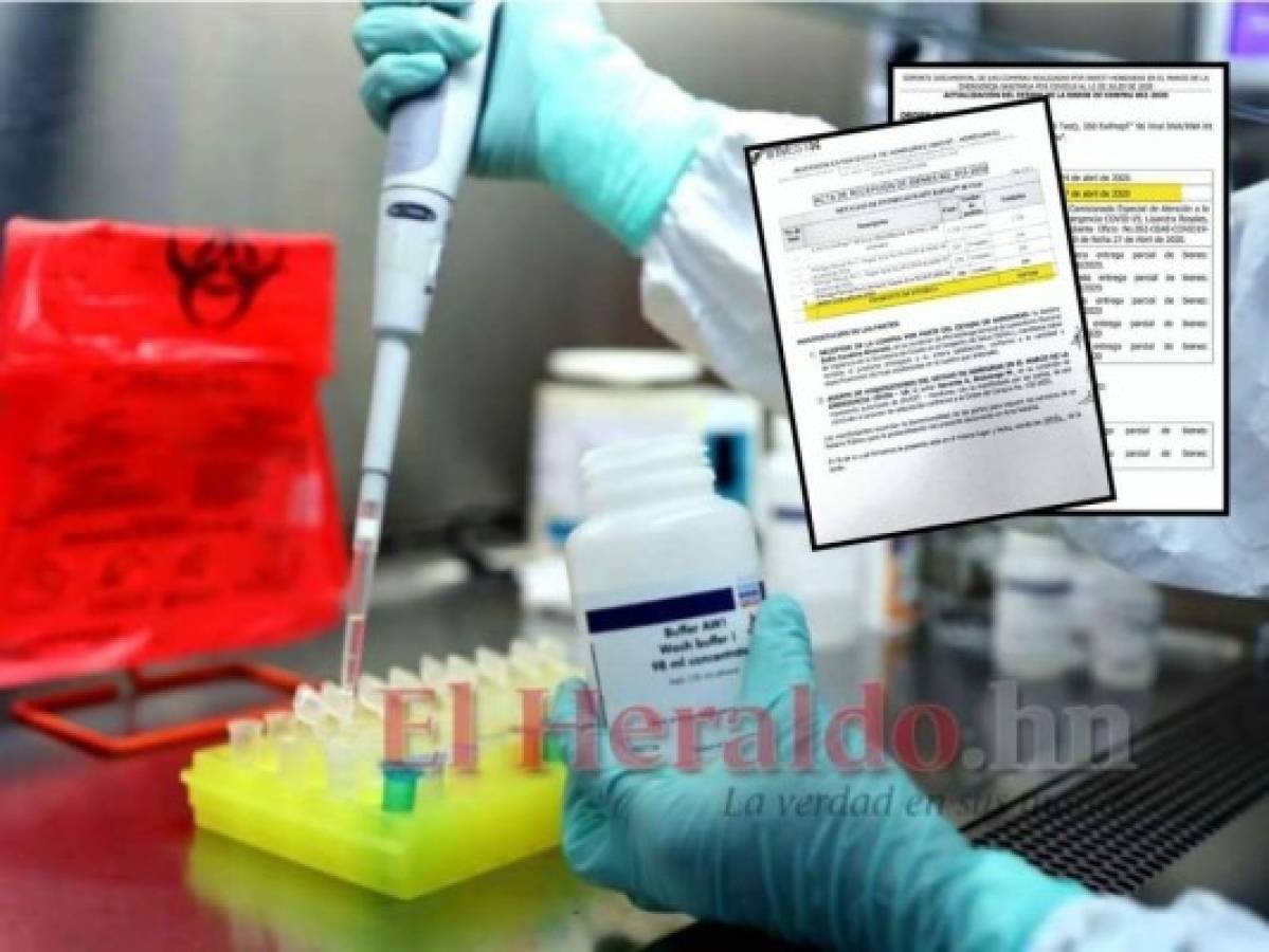 Reactivos para pruebas PCR no llegan a Honduras porque Invest-H no paga