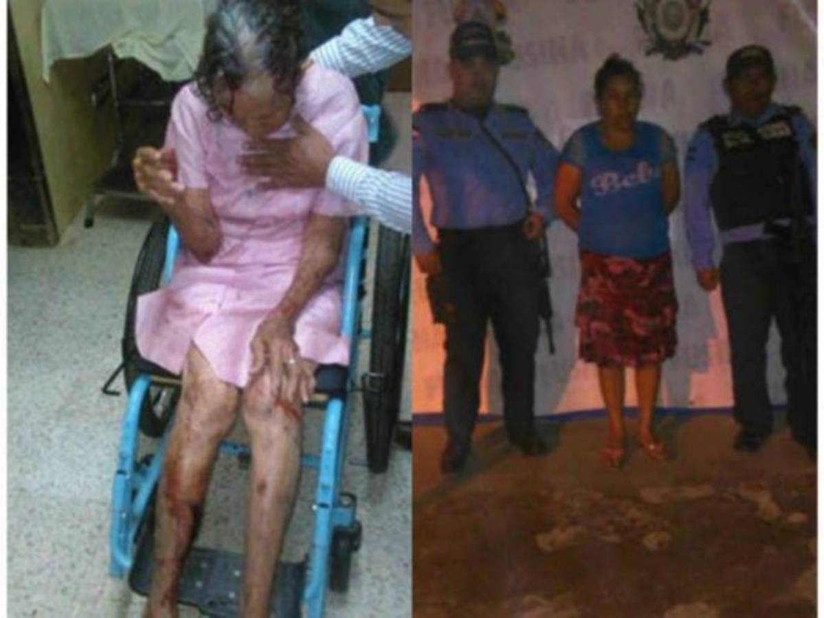 Honduras: Anciana de 91 años es brutalmente golpeada por una mujer