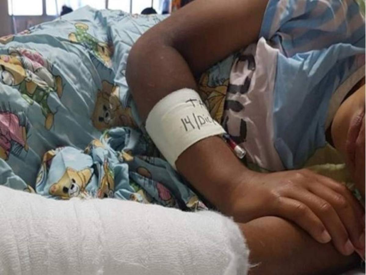 Una niña de 13 años, quinta víctima de la pólvora en Honduras