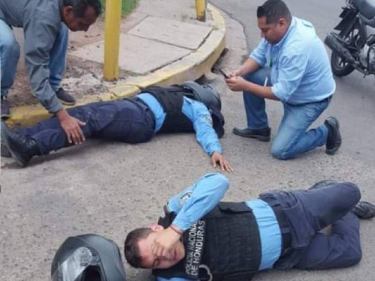 Policías resultan heridos al ser embestidos por automóvil en la capital