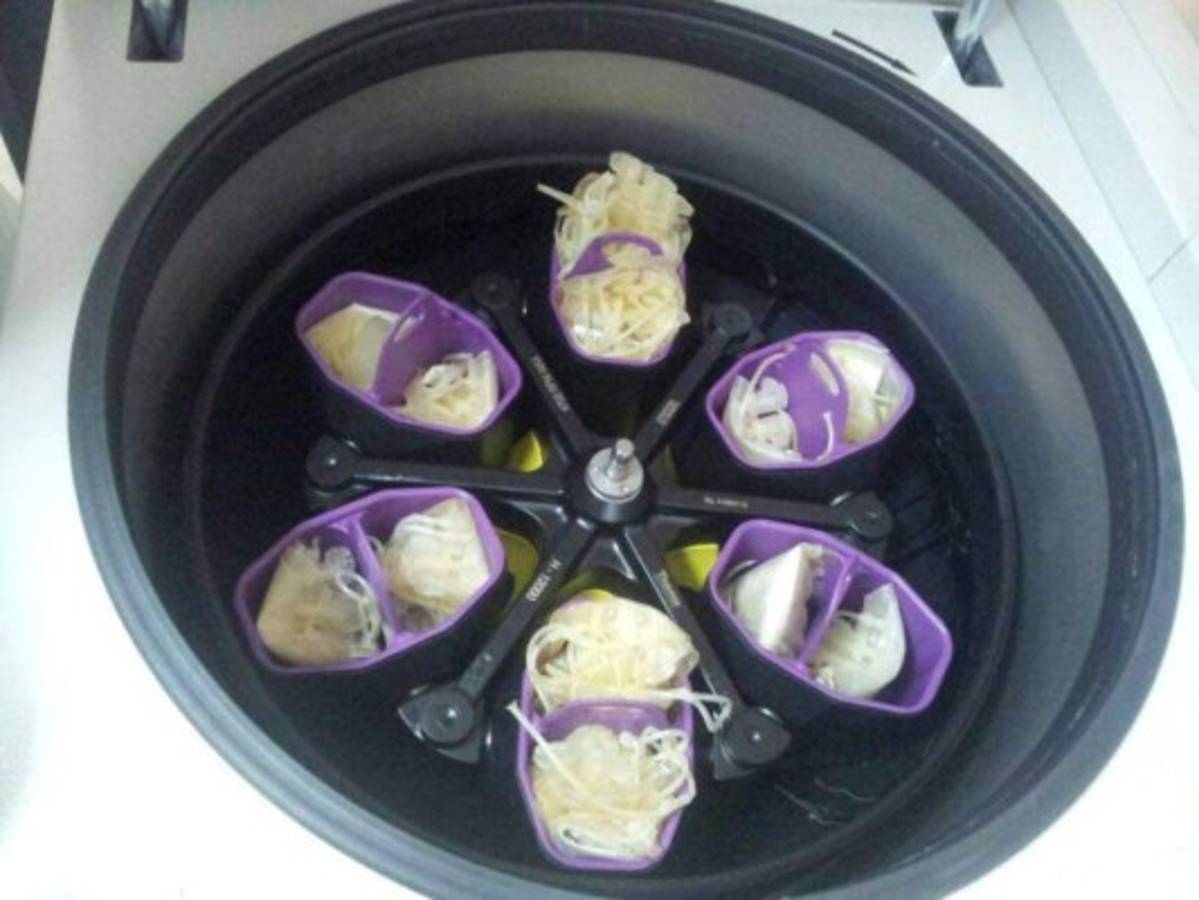 El HEU triplica capacidad de separación de componentes de la sangre  