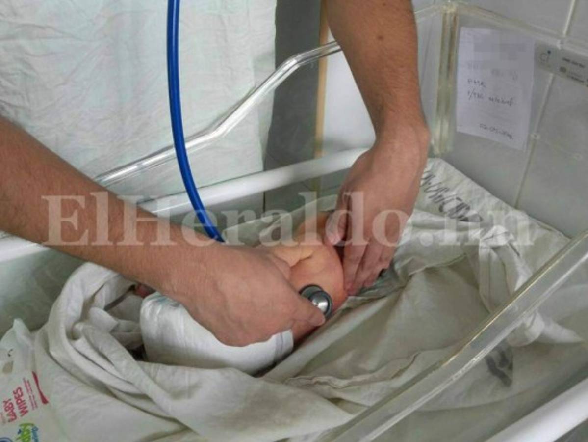 Honduras: Salud declara emergencia por casos de microcefalia en Choluteca