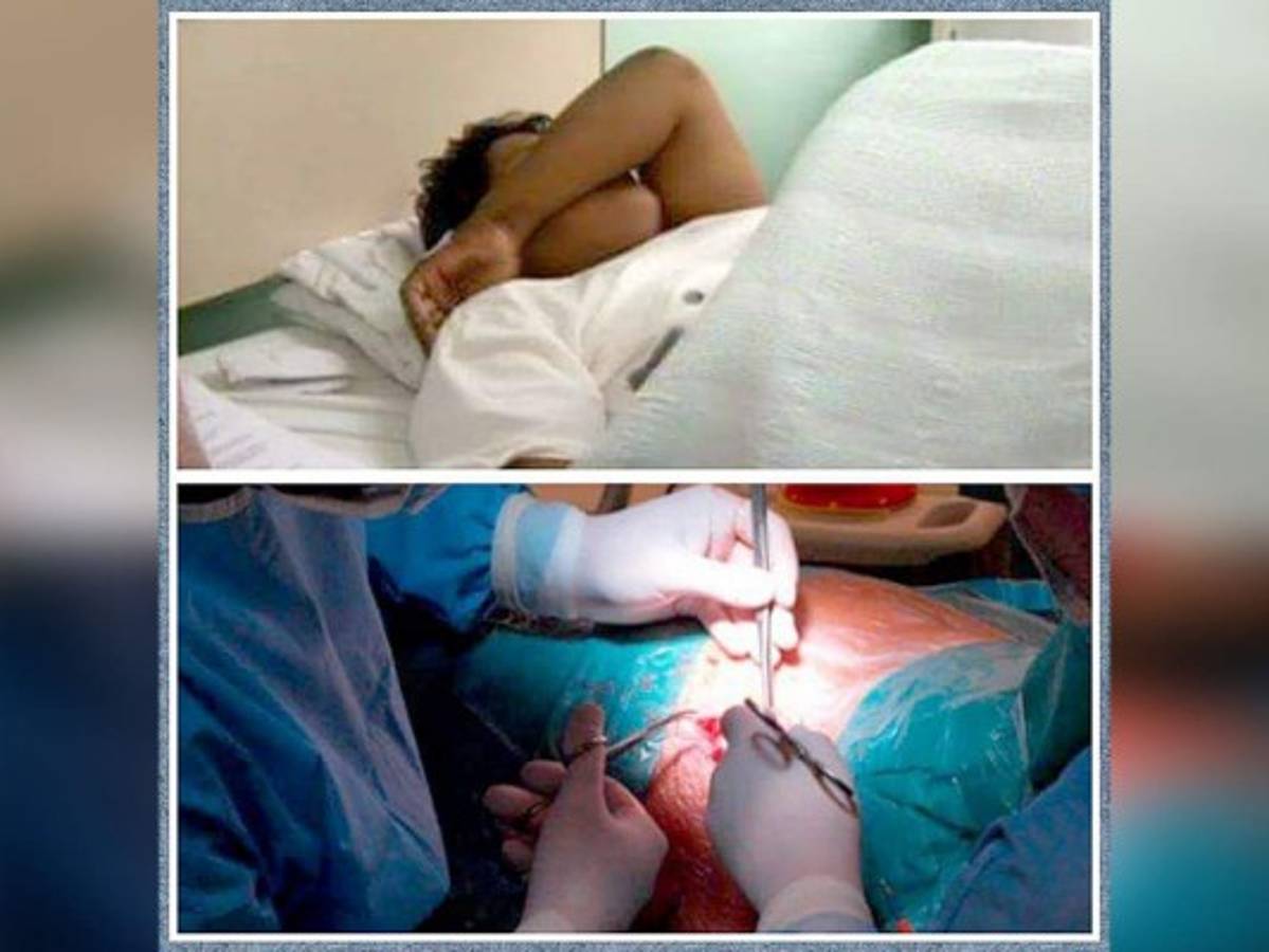 Hondureño se amputa pene y testículos