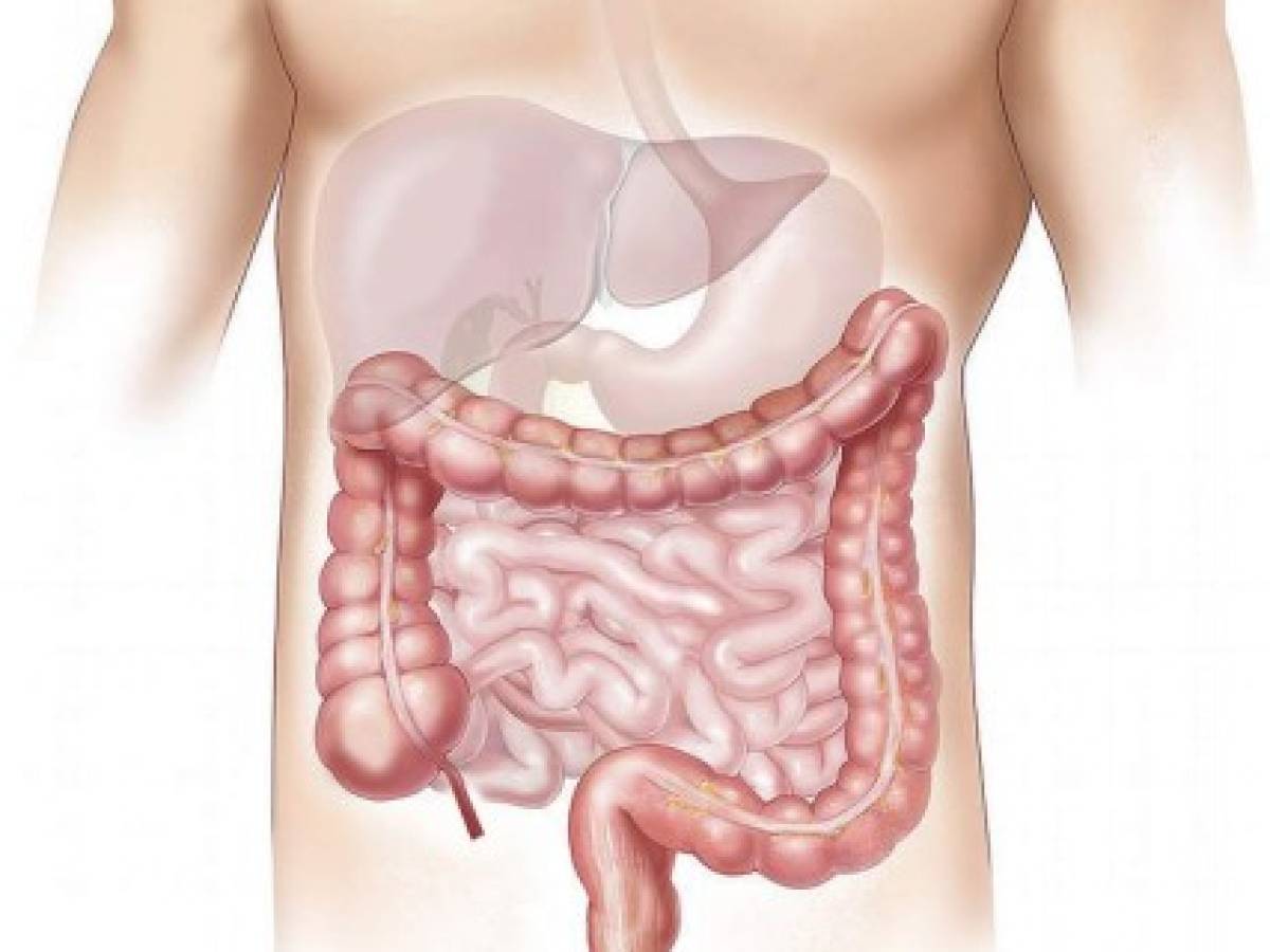 Siete síntomas de cáncer de colon que no puede pasar por alto