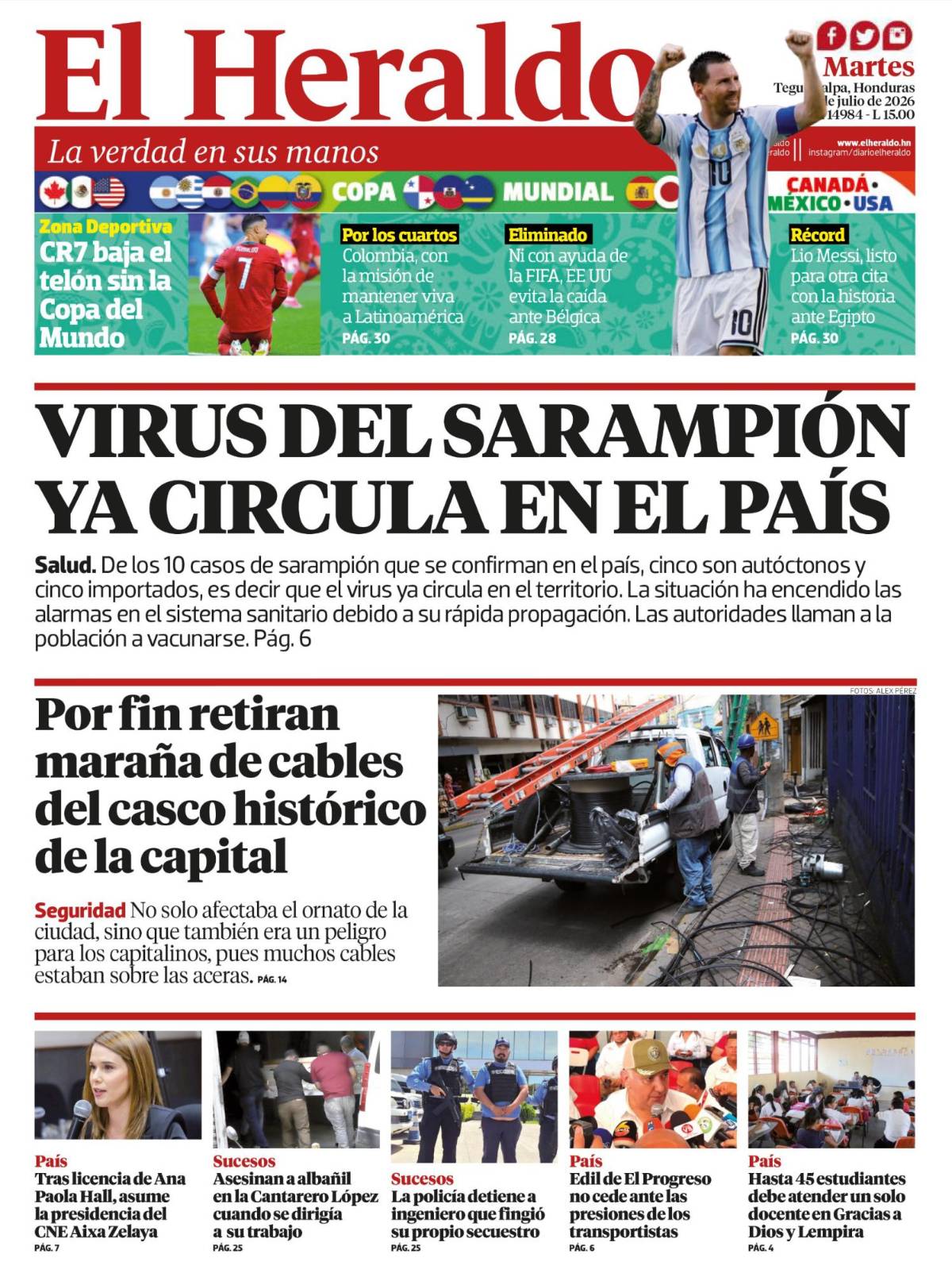 Virus del sarampión ya circula en el país