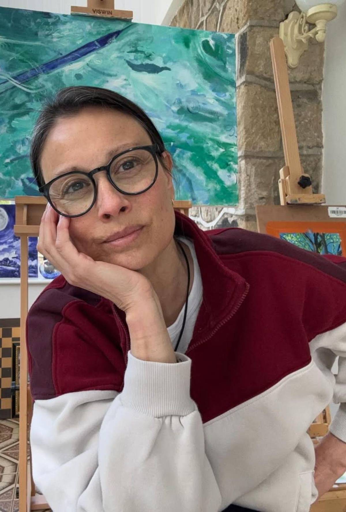 Exmodelo Melanie Sykes, casi calva: enfermedad autoinmune le destruyó el cabello