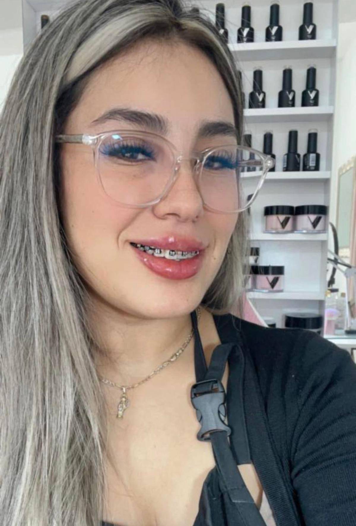 Influencer muere a los 30 años durante cirugía estética en Tijuana