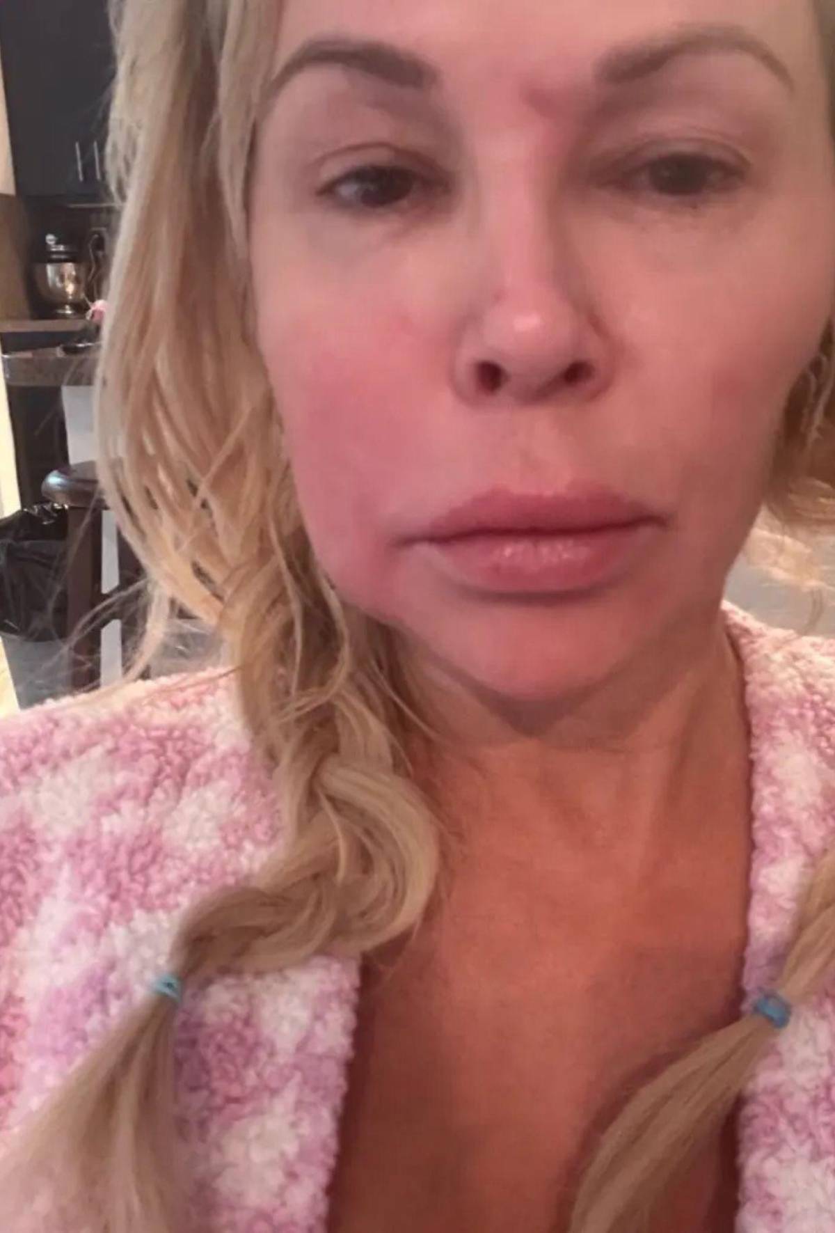 Ha sido un infierno: exestrella de reality obtiene diagnóstico tras batallar con parásito facial