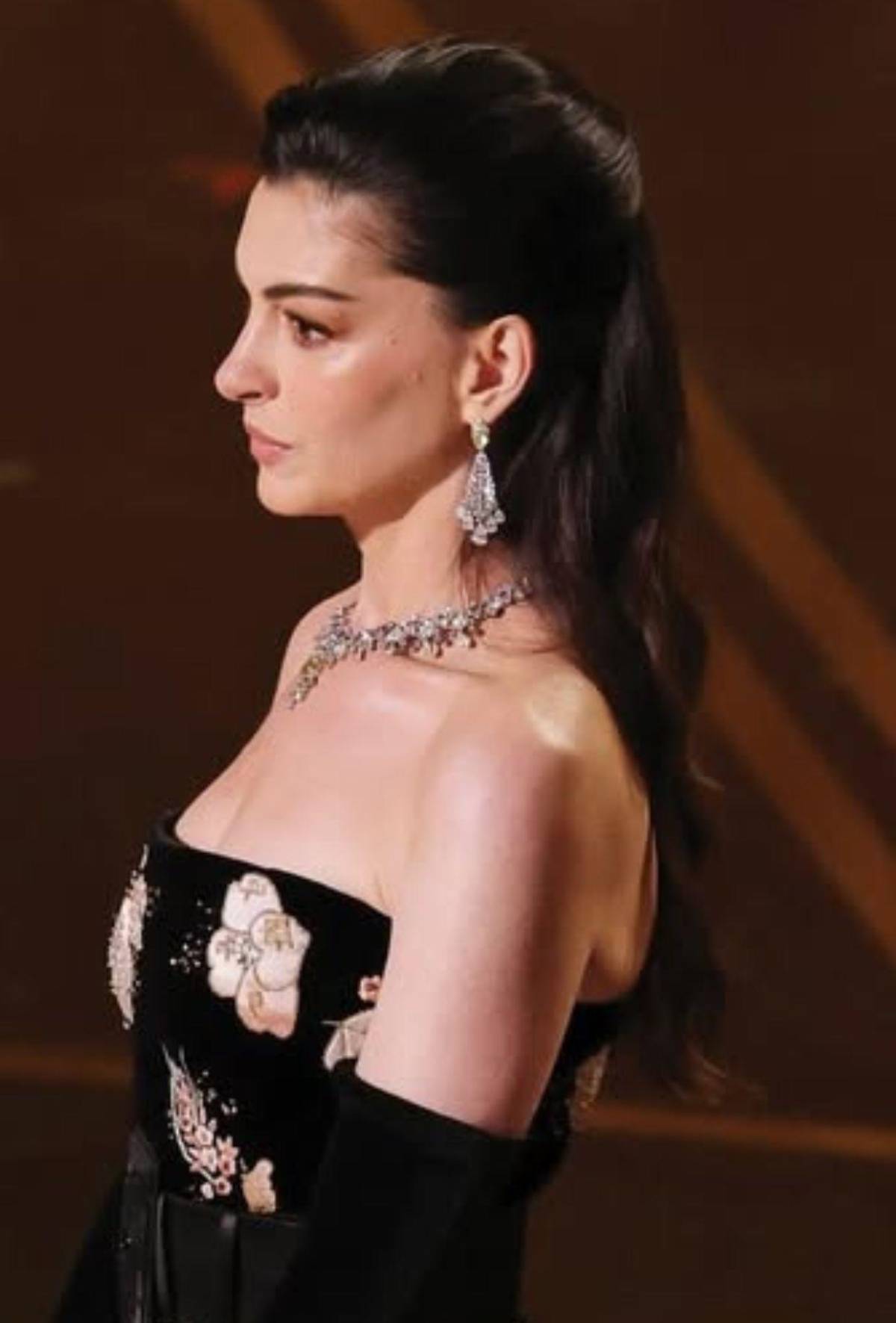 Así consiguió Anne Hathaway su efecto lifting en los Oscar sin pasar por el quirófano