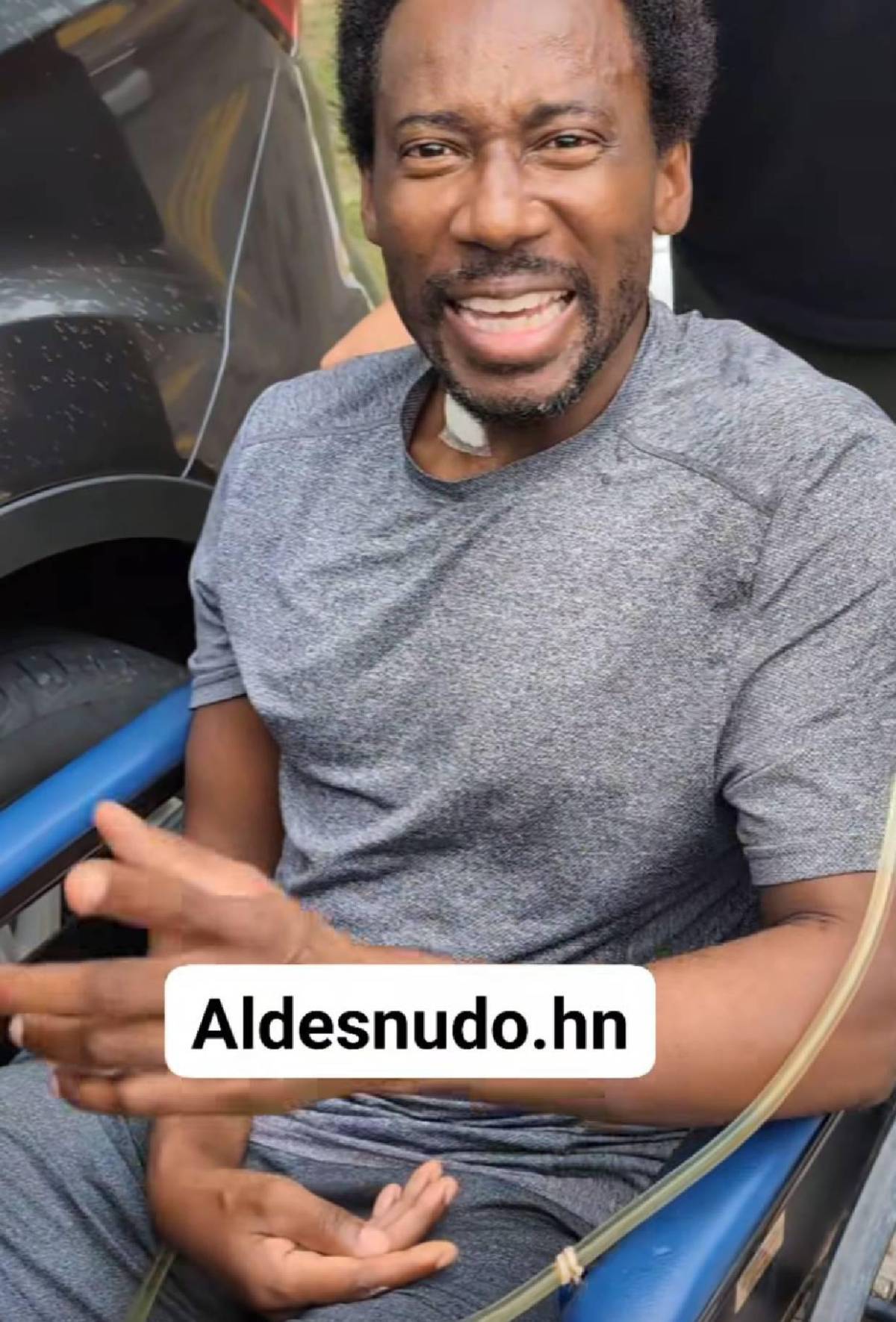 Revelado: El estado de salud del periodista Limber Pérez tras sufrir derrame cerebral