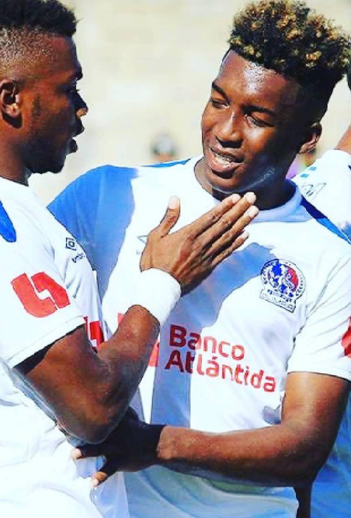 Futbolista hondureño fue tiroteado en SPS: Así vivió el momento que lo tuvo al borde de la muerte