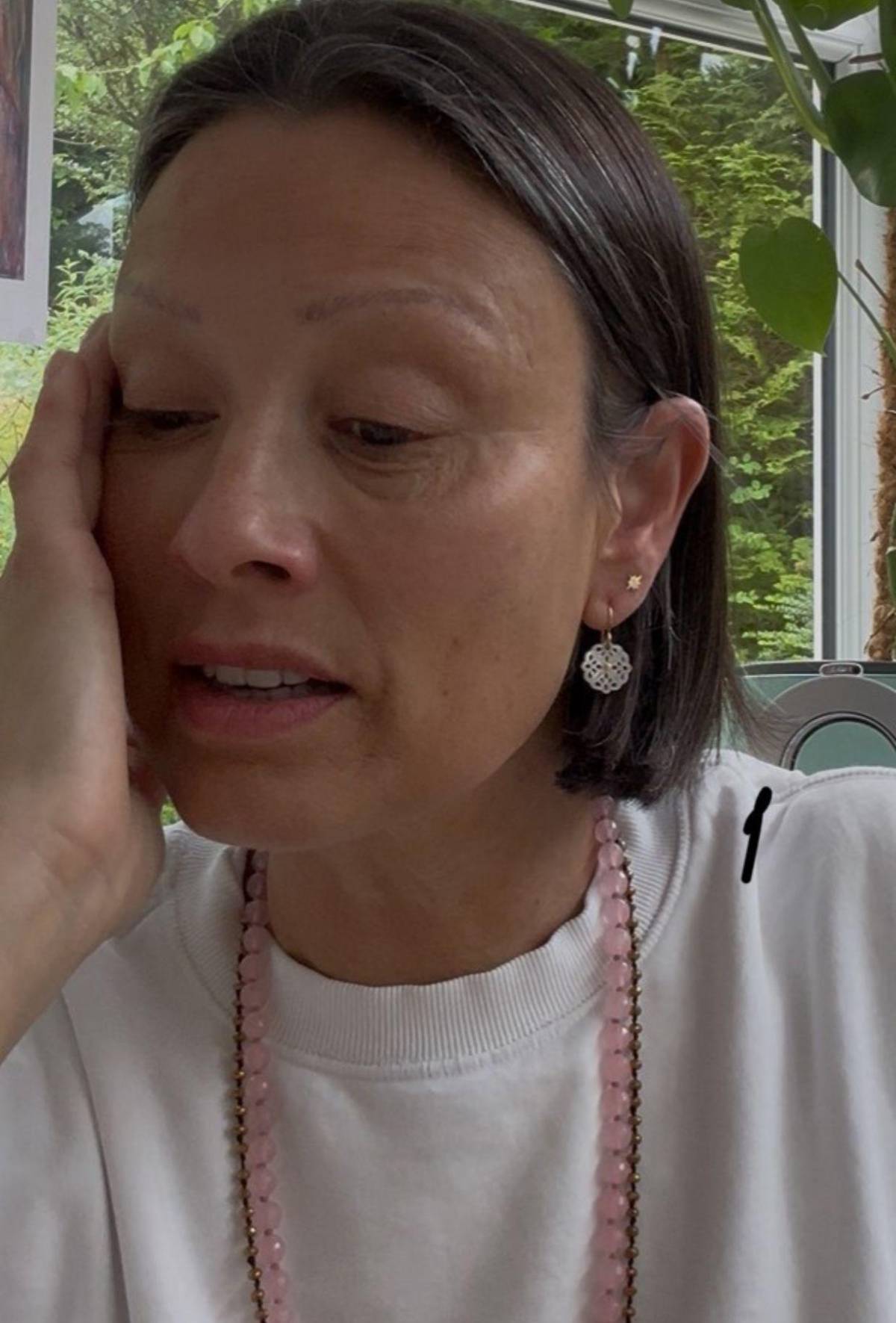 Exmodelo Melanie Sykes, casi calva: enfermedad autoinmune le destruyó el cabello