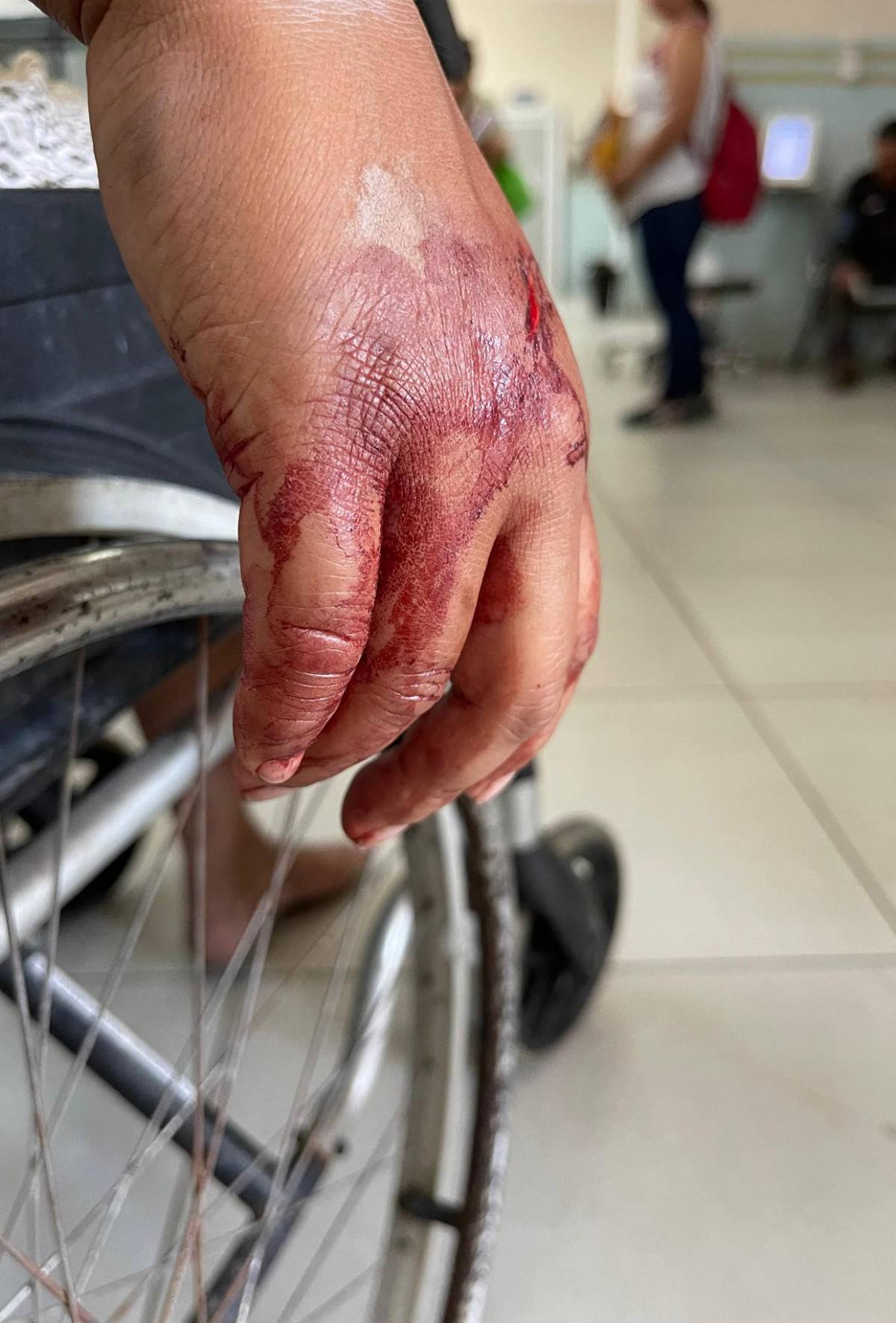 Trasladan al Hospital Escuela a 10 heridos del accidente en Villa Nueva; hay dos niños