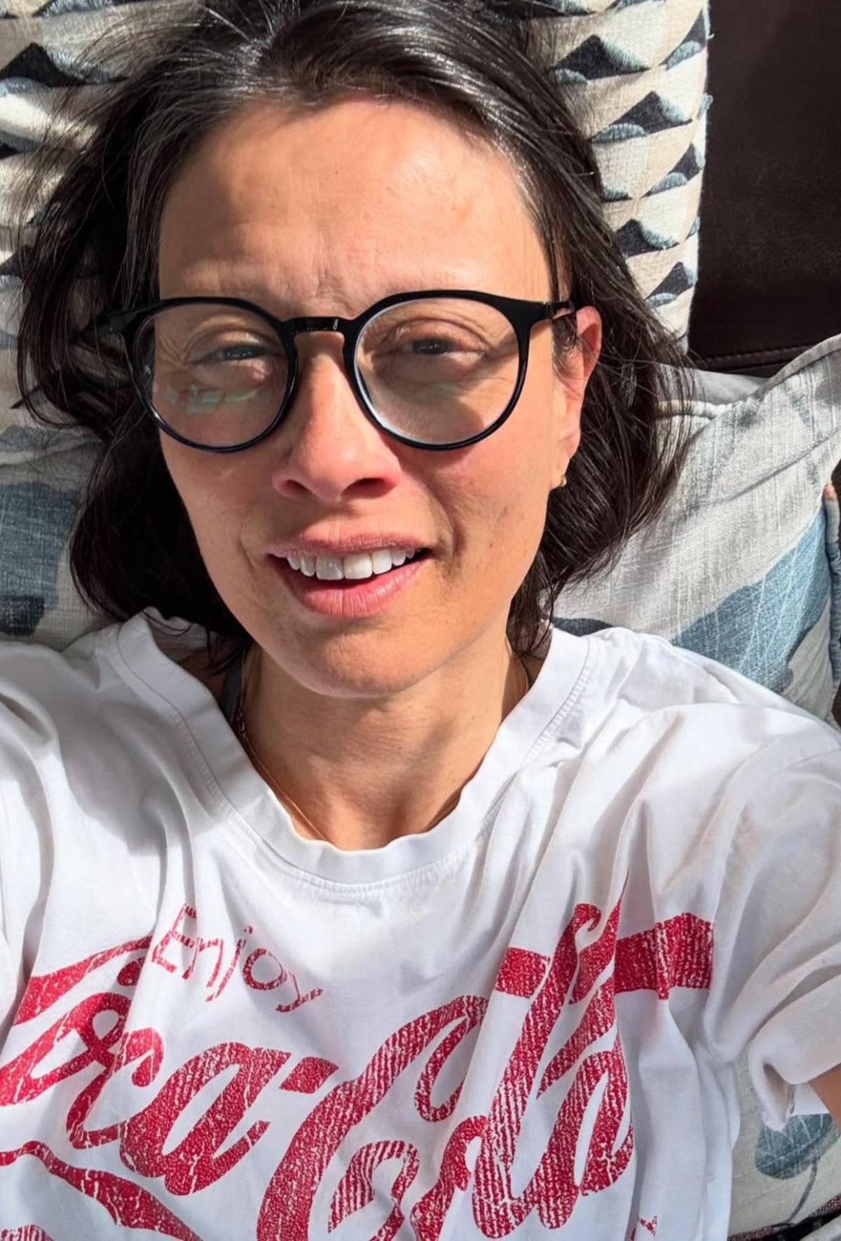 Exmodelo Melanie Sykes, casi calva: enfermedad autoinmune le destruyó el cabello