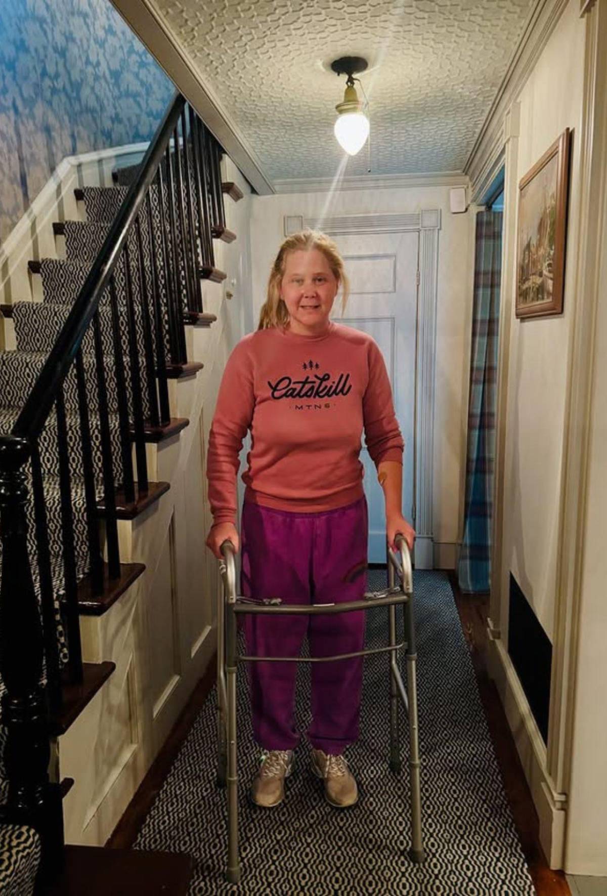 Así luce Amy Schumer tras su notable cambio de peso: las reacciones en redes