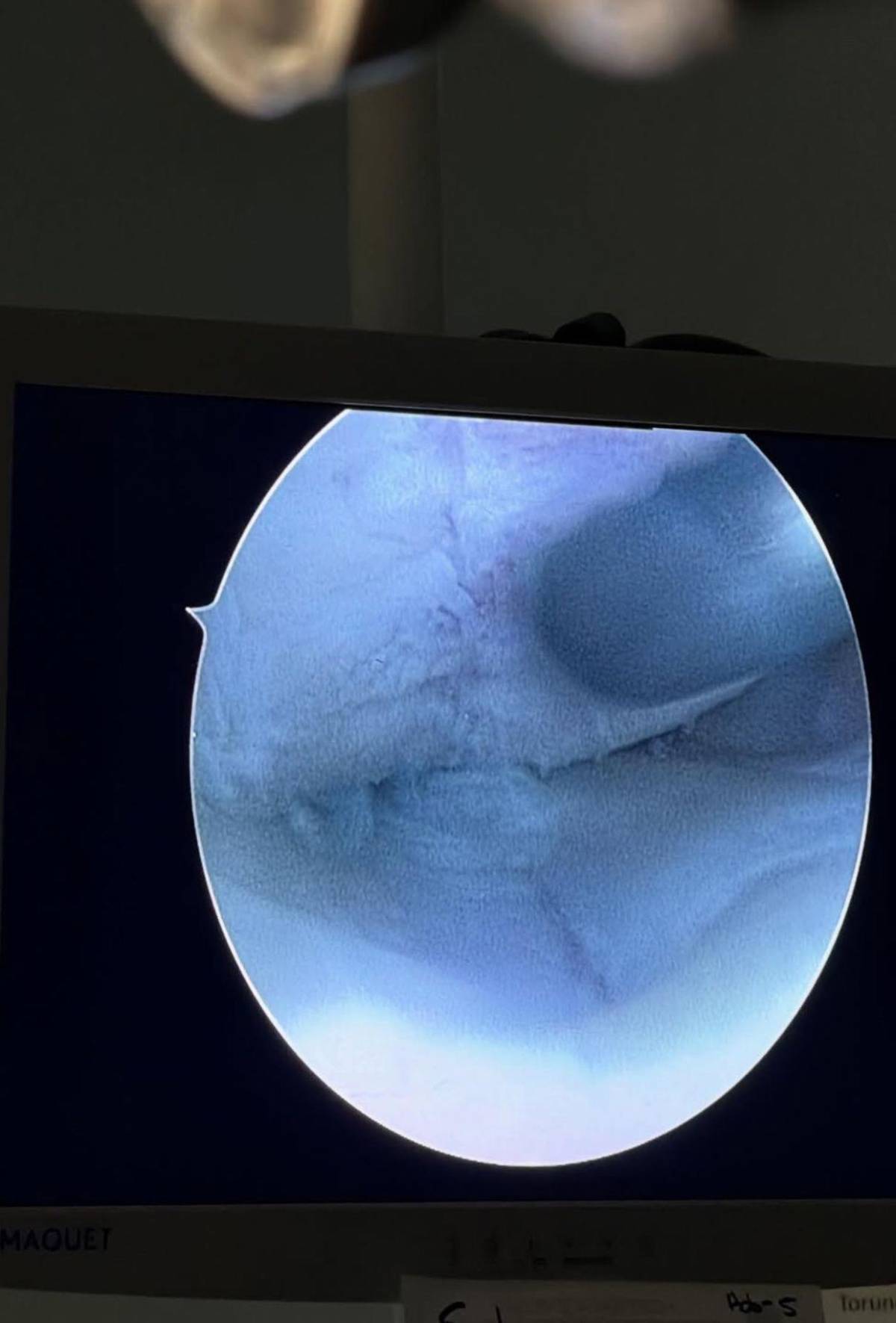 Shin Fujiyama se somete a cirugía: Llego el día, mi gente