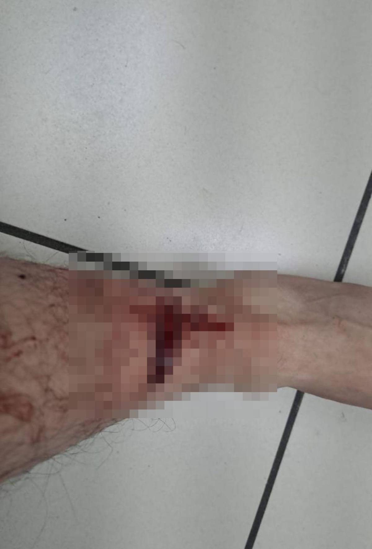 Armas de guerra y un detenido, ¿qué se sabe del operativo en la colonia Estados Unidos?