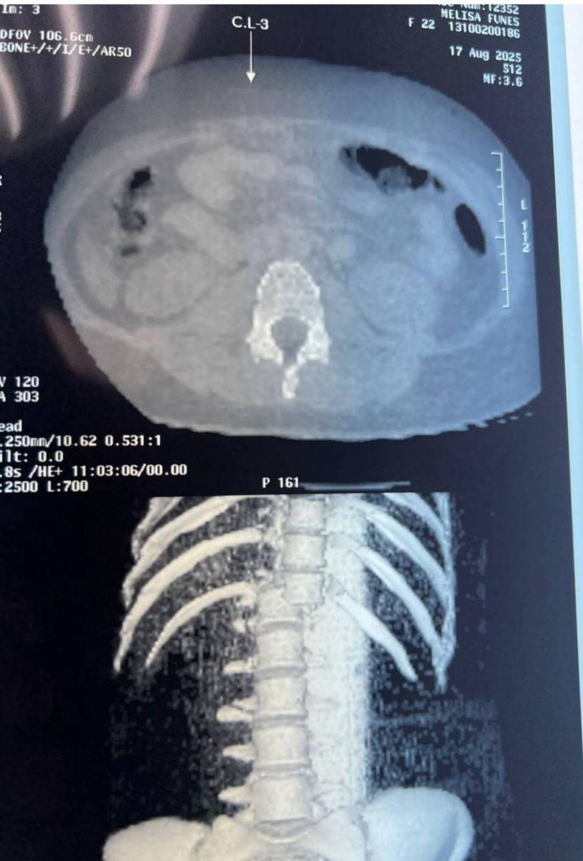 Joven cae de juego mecánico en feria de Santa Rosa de Copán