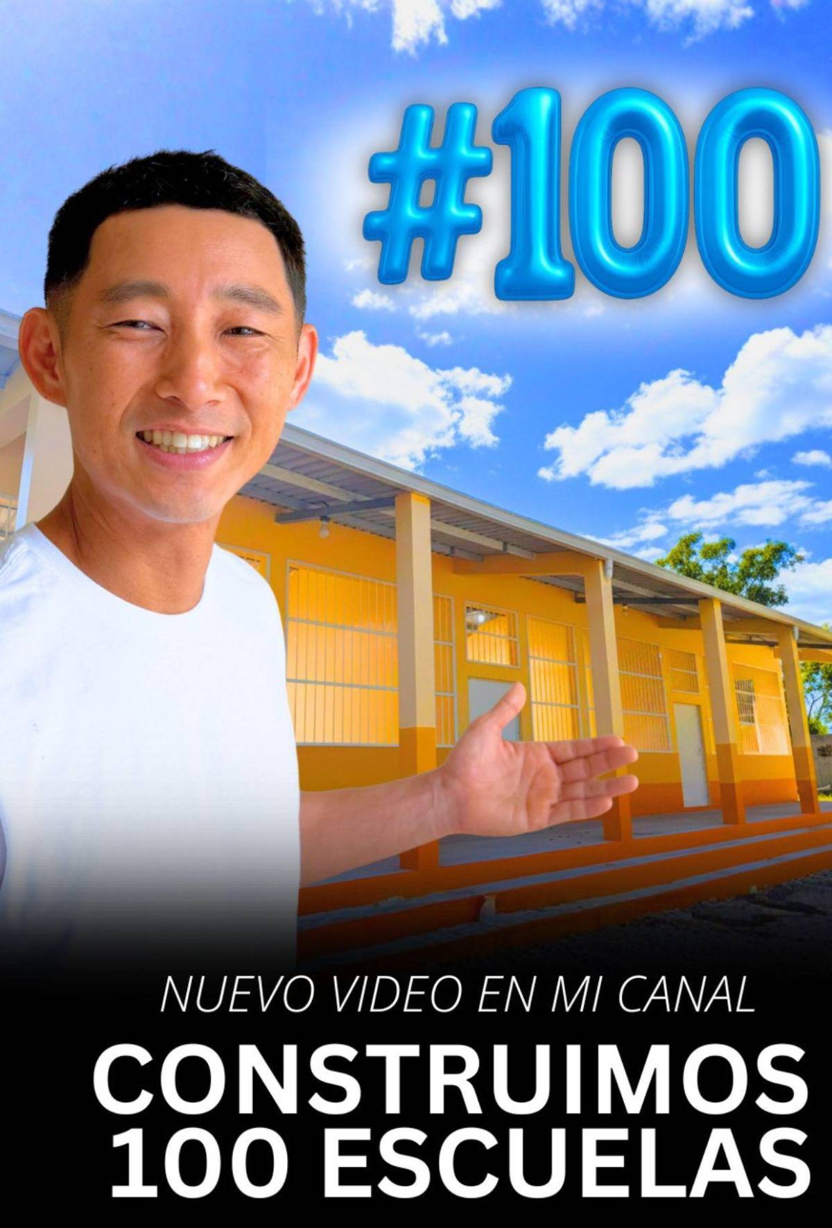 Shin Fujiyama se somete a cirugía: Llego el día, mi gente