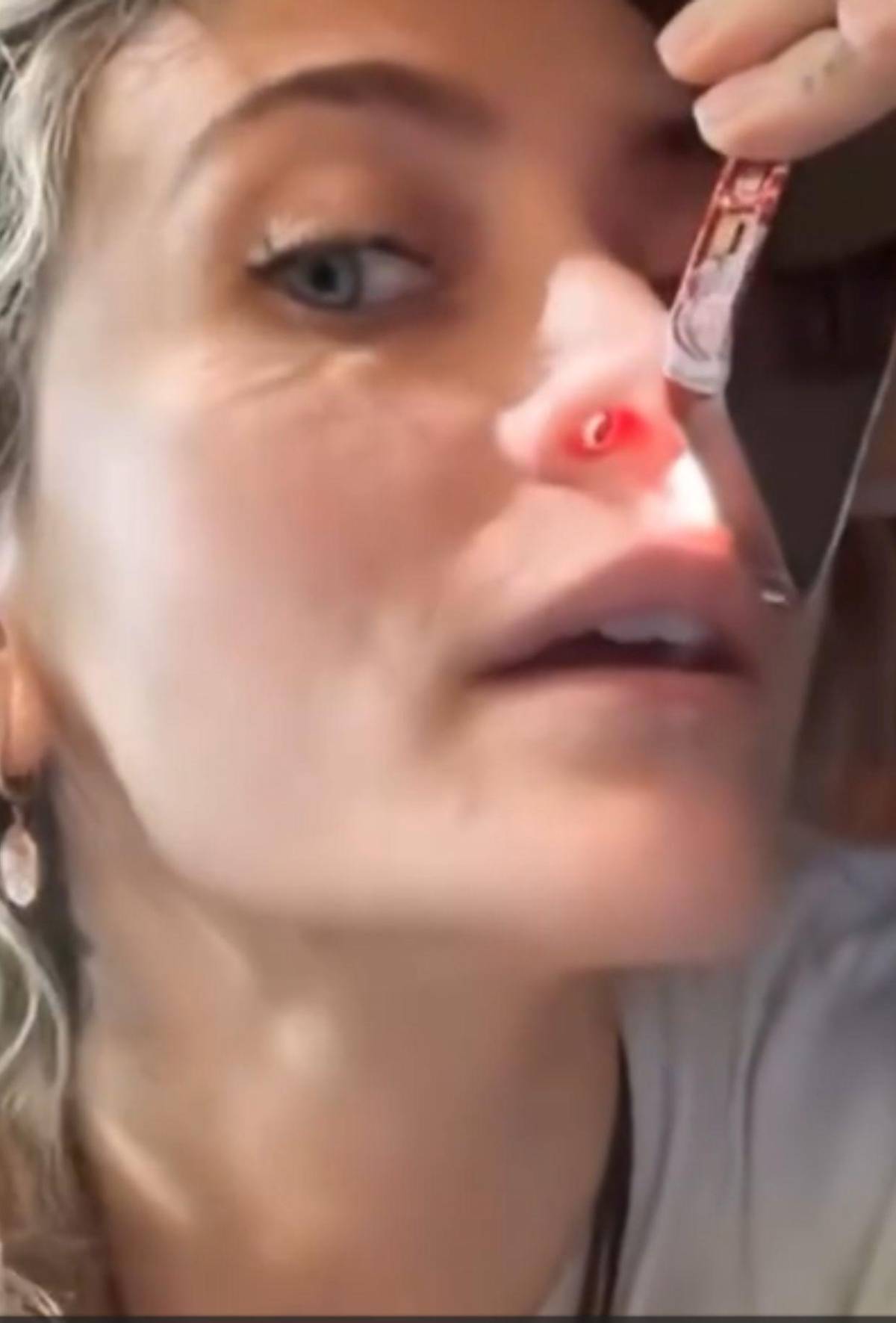 Paris Jackson muestra los daños que el consumo de drogas dejó en su nariz