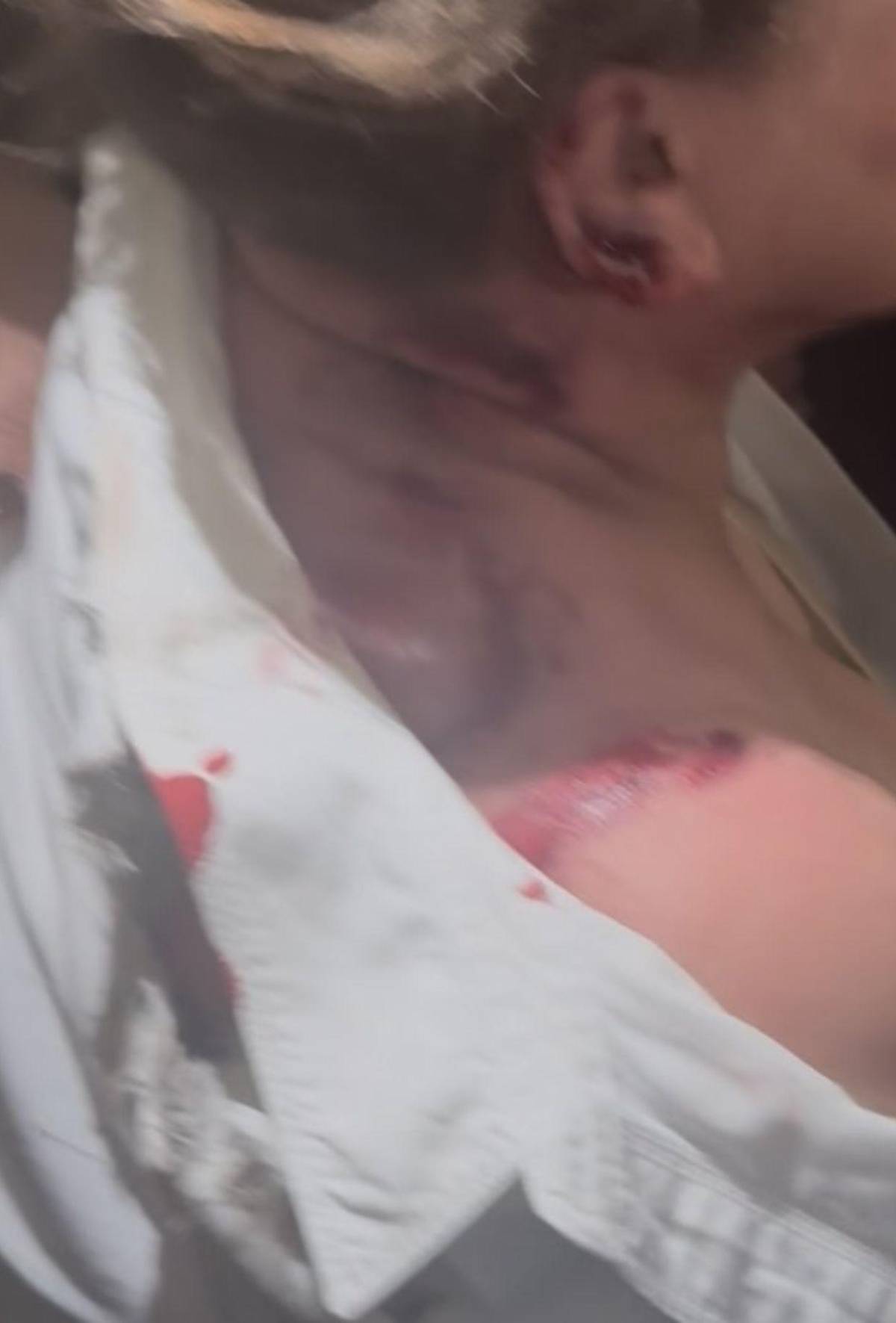 Lo que informa el 911 sobre el ataque con explosivo a diputada Gladis Aurora López