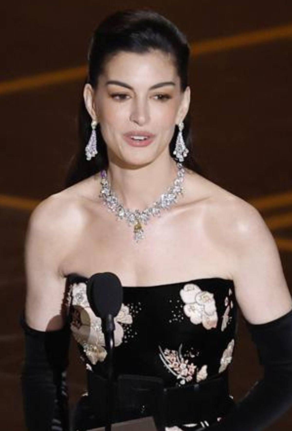 Así consiguió Anne Hathaway su efecto lifting en los Oscar sin pasar por el quirófano