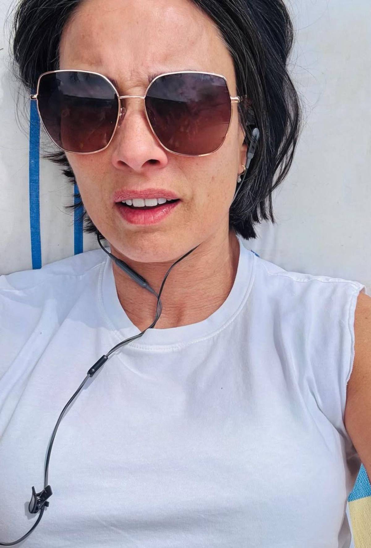 Exmodelo Melanie Sykes, casi calva: enfermedad autoinmune le destruyó el cabello