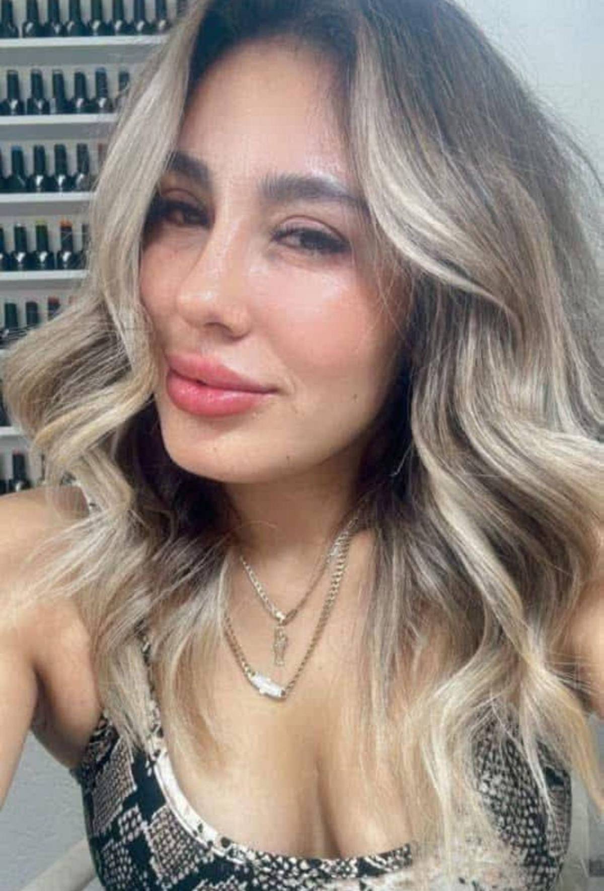 Influencer muere a los 30 años durante cirugía estética en Tijuana