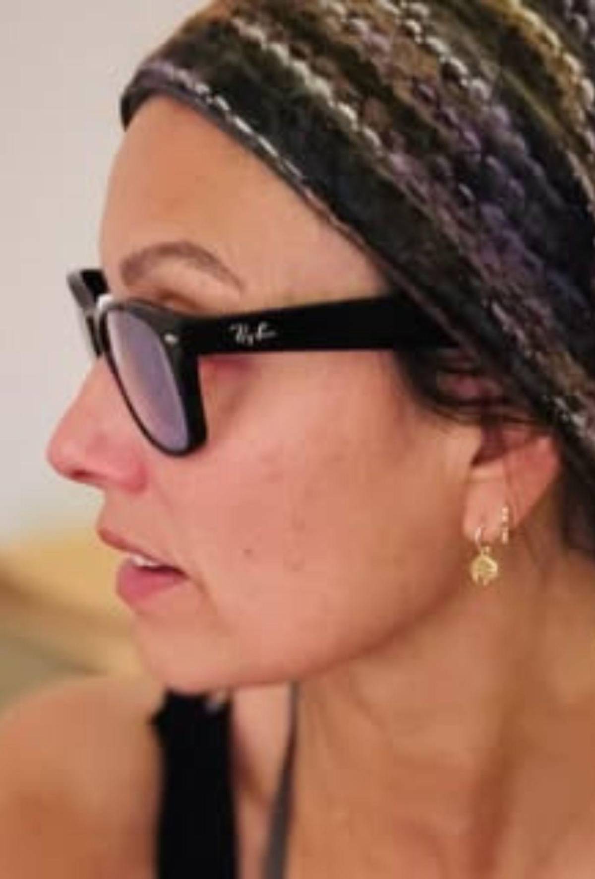 Exmodelo Melanie Sykes, casi calva: enfermedad autoinmune le destruyó el cabello