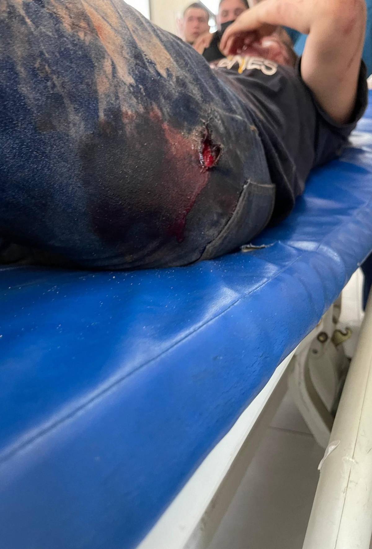 Trasladan al Hospital Escuela a 10 heridos del accidente en Villa Nueva; hay dos niños