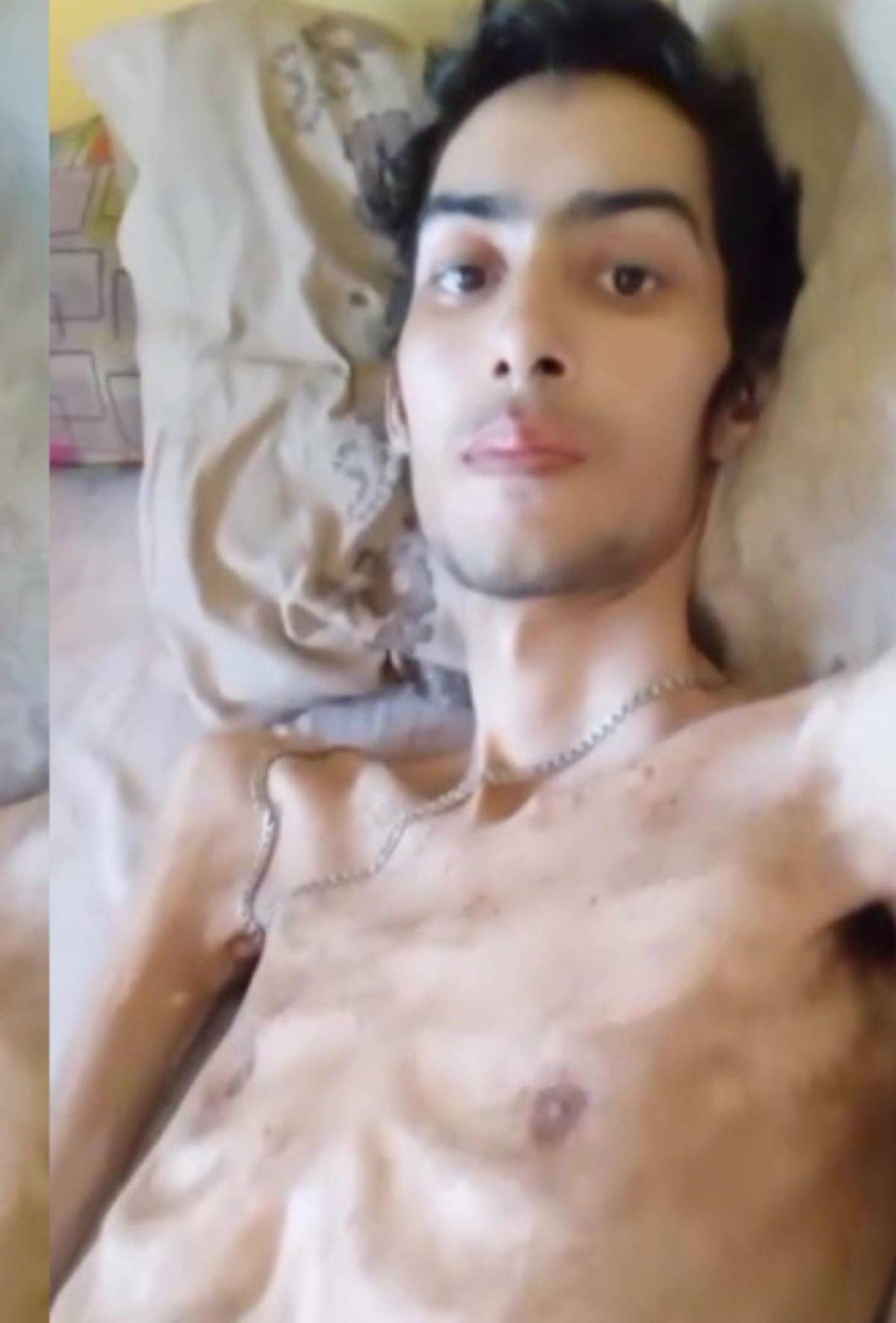 Muere joven de La Ceiba que clamaba por TikTok un cupo en el hospital, ¿de qué falleció?