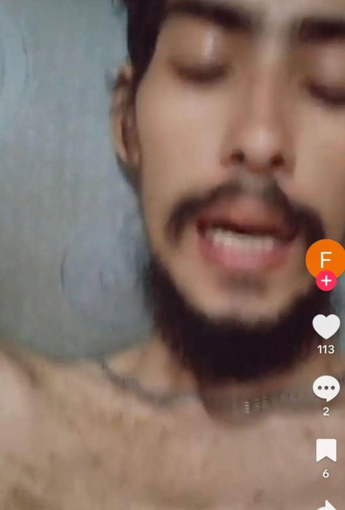 Muere joven de La Ceiba que clamaba por TikTok un cupo en el hospital, ¿de qué falleció?