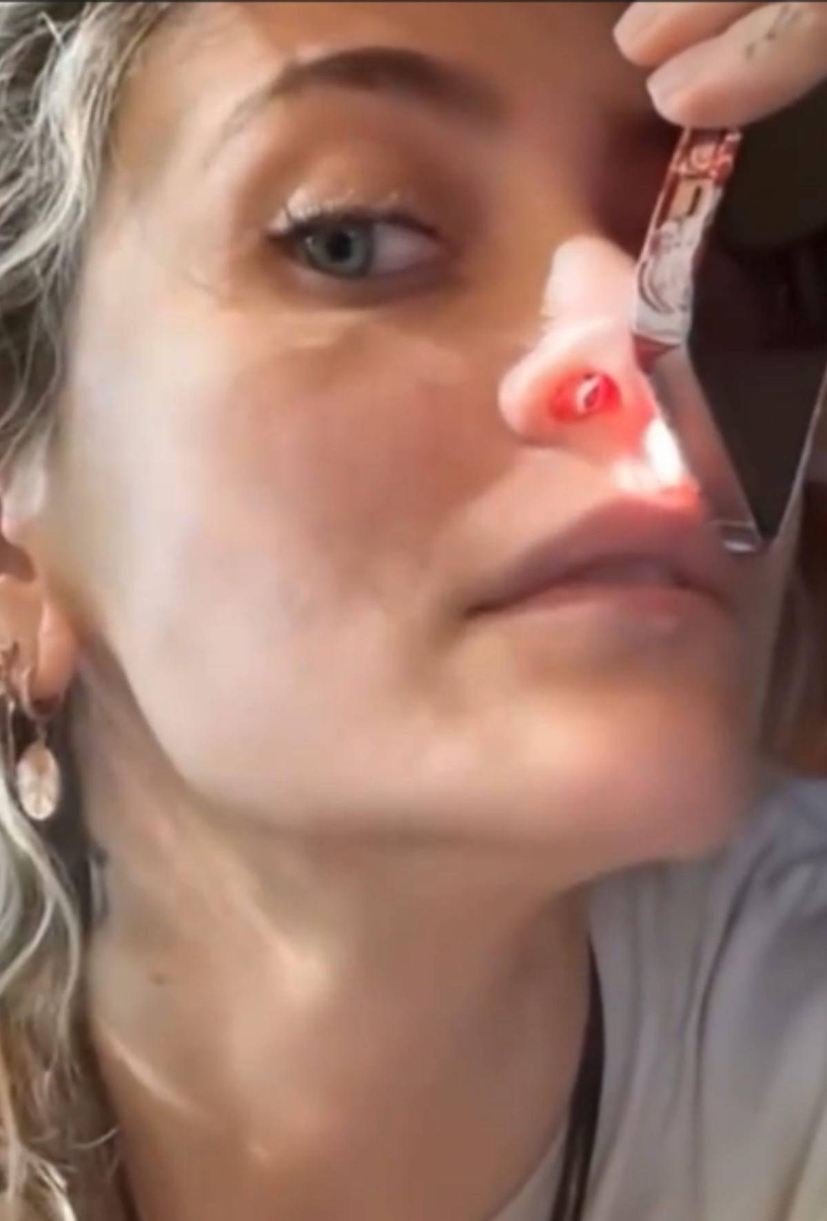 Paris Jackson muestra los daños que el consumo de drogas dejó en su nariz