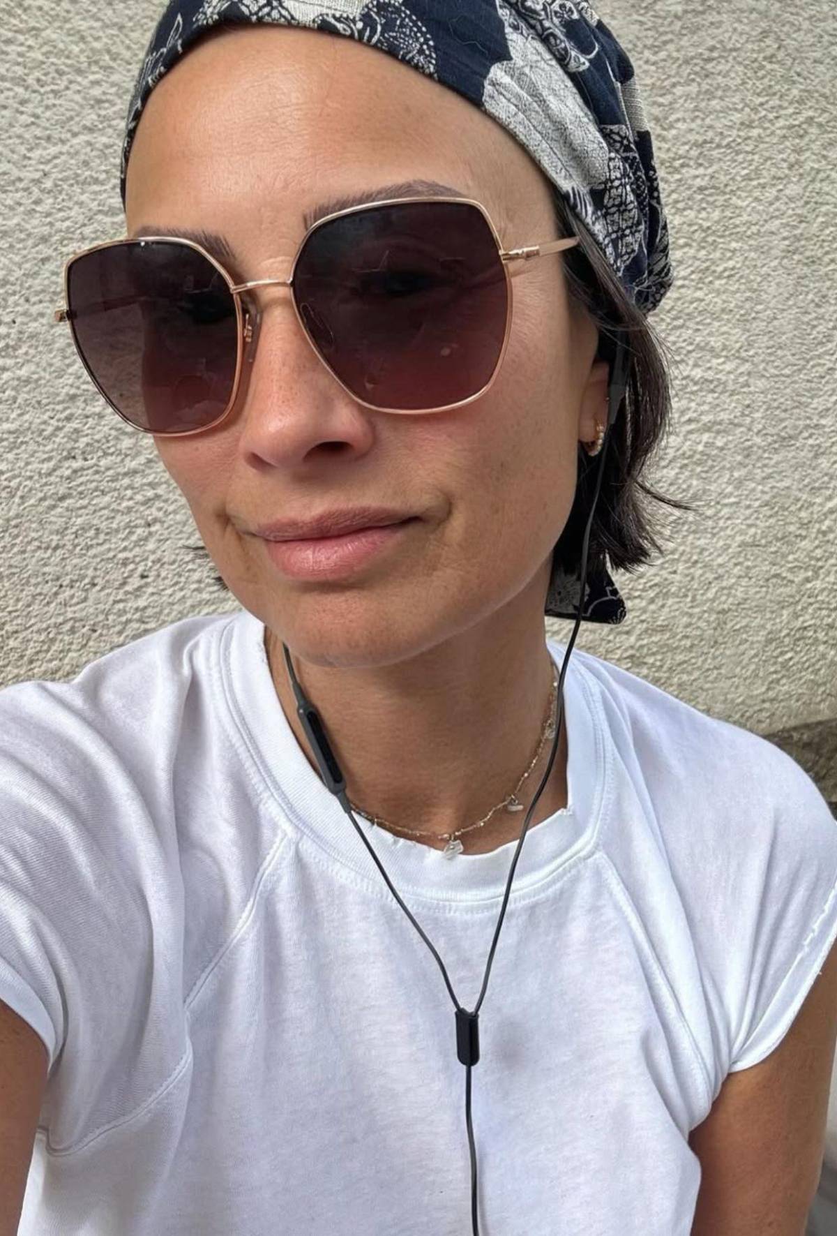 Exmodelo Melanie Sykes, casi calva: enfermedad autoinmune le destruyó el cabello