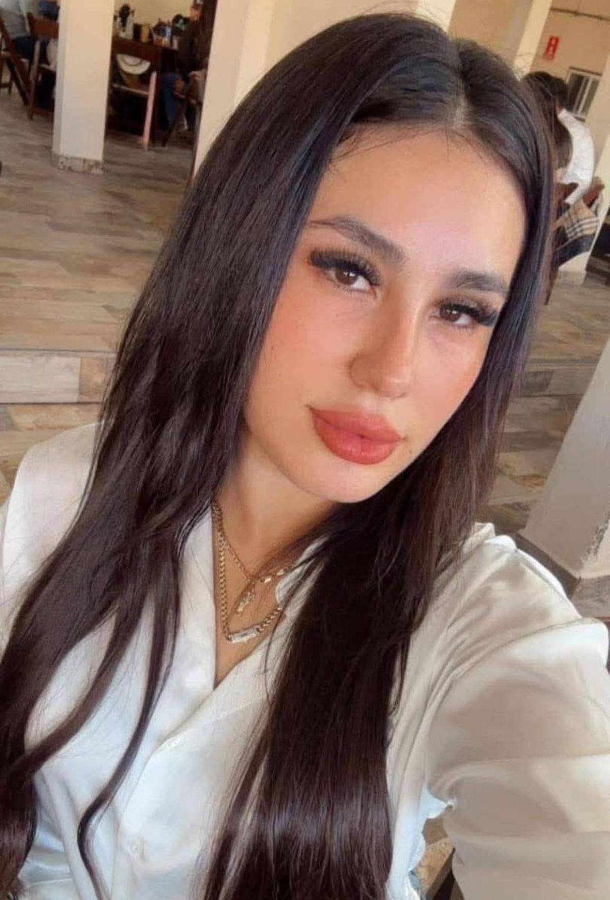 Influencer muere a los 30 años durante cirugía estética en Tijuana