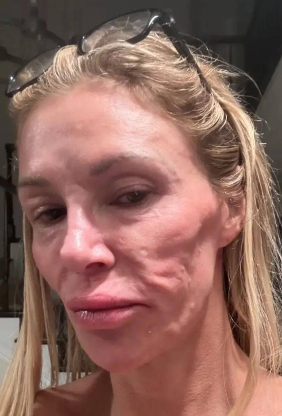 Ha sido un infierno: exestrella de reality obtiene diagnóstico tras batallar con parásito facial