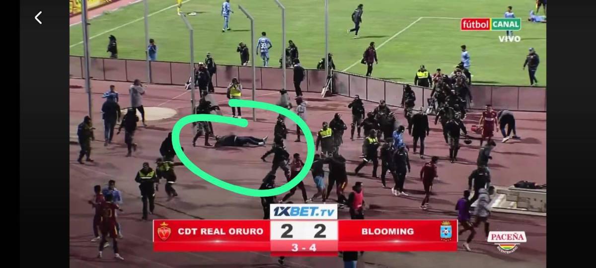 Partido de fútbol termina en batalla campal; 17 expulsados y directivo fracturado