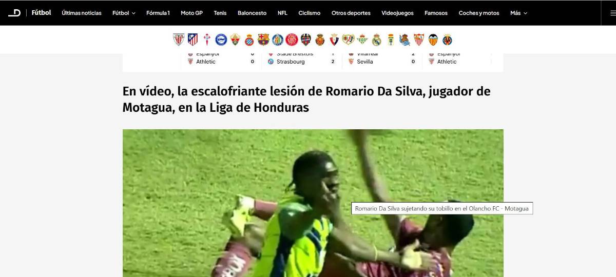 Así reaccionan los medios internacionales tras terrible lesión de Romario da Silva